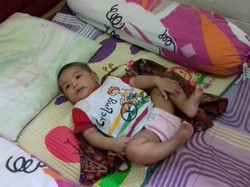 Bayi Anak Tukang Bubur yang Dahulu Sakit dan Butuh Biaya Kini Sudah Sehat, ini Fotonya