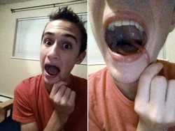 Kisah Sam, Remaja yang Bisa Menarik Anak Tekaknya Hingga 8,25 Cm