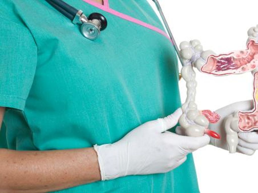Banyak Makan Pedas Bikin Usus Buntu? Ini Penjelasan Dokter Banyak Makan Pedas Bikin Usus Buntu? Ini Penjelasan Dokter