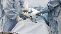 Dikira Sudah Tewas, Wanita 38 Tahun Ini Hidup Lagi Sesaat Sebelum Diambil Organnya
