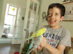 Bocah Ini Tolak Dioperasi Meski Separuh Wajah Tertutup Tumor