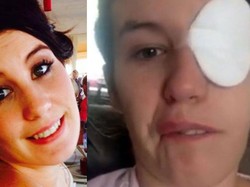 Mirip Stroke, Wajah Wanita Ini Terus-terusan Lumpuh karena Kondisi Langka