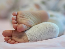 Konsumsi Vitamin B Kompleks Bisa Kurangi Nyeri Terkilir pada Anak?