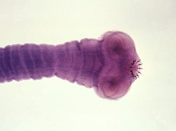 Cacing Pita Sepanjang 5 Meter Ditemukan di Tubuh Lelaki Penggemar Sushi