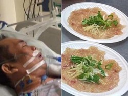 Usai Menyantap Ikan Mentah, Pria Ini Terserang Sindrom Langka Sampai Koma