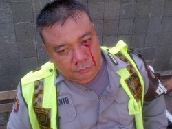 Kena Pukul Pendemo di HI, Wajah Anggota Polres Jakpus Bercucuran Darah