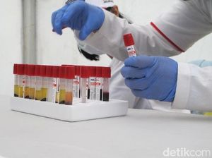 Arti Reaktif HIV-Sifilis Menurut Dokter, Dialami 30 Peserta Pesta Gay di Puncak Arti Reaktif HIV-Sifilis Menurut Dokter, Dialami 30 Peserta Pesta Gay di Puncak
