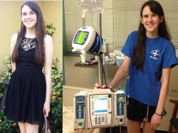 Mengidap Kondisi Langka, Nancy Kehilangan Bobot 9 Kg Pertahun