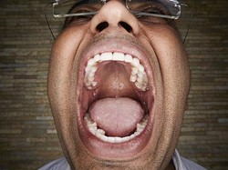 Aneh bin Nyata, 200 Gigi Mendadak Tumbuh di Mulut Pria Ini