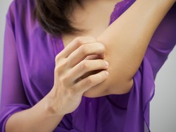 Wanita Ini Mendadak Alergi Air Usai Melahirkan