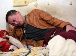 Agar Tak Lagi Kecanduan Alkohol, Pria Ini Rela Lehernya Dirantai