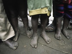 Pakar Global Bicara Kelaparan Tersembunyi di Lokakarya KFI & IGI