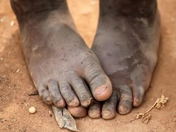 PBB Sebut 2,4 Juta Orang Butuh Bantuan Pangan di Mali-Niger