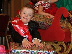 Kisah Bocah dengan Down Syndrome yang Puluhan Kali Juarai Kontes Kecantikan