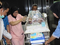 Kritis, Bayi Kembar Siam Ivon-Ivana Terpaksa Jalani Operasi Pemisahan