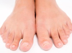 Penyebab Bisul di Kaki