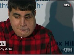 Pipi yang Bengkak dan Melorot Selesai Dioperasi, Remaja Ini Siap Sekolah Lagi