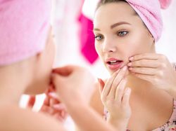 5 Produk yang Bisa Kempiskan Jerawat dalam Semalam