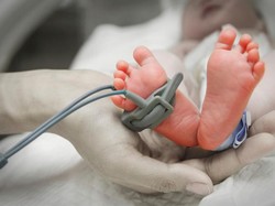 Idap Penyakit Langka, Kulit Kakak-Adik Ini Mengelupas bila Digaruk