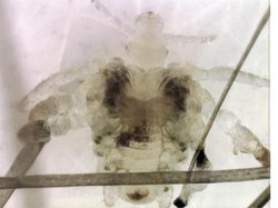 Kemaluannya Gatal-gatal, Ternyata Pria Ini Terjangkit Kutu Kelamin