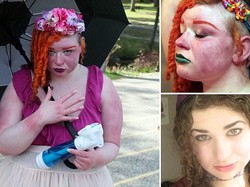 Idap Kondisi Langka, Wanita Ini Merasa Seperti Terbakar Setiap Waktu