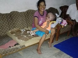 Balita Penderita Hydrocephalus di Banyuwangi ini Butuh Pertolongan Medis