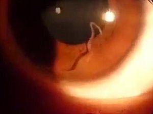Cacing Gelang Sangat Berbahaya bagi Manusia, Ternyata Virus Ini Penyebabnya Cacing Gelang Sangat Berbahaya bagi Manusia, Ternyata Virus Ini Penyebabnya