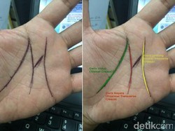 Garis Tangan Bertanda M, Benarkah Istimewa? Yuk Tanya Dokter