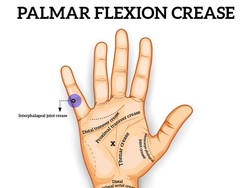 Menelusuri Asal Muasal Garis Tangan yang Misterius