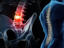 Chiropractic Masuk ke Indonesia 15 Tahun Lalu