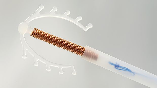 7 Mitos dan Fakta tentang Alat Kontrasepsi IUD