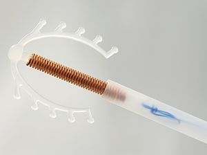 Ingin Pasang KB Spiral? Ini Jangka Waktu yang Disarankan Dokter Kandungan Ingin Pasang KB Spiral? Ini Jangka Waktu yang Disarankan Dokter Kandungan