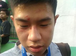 Penertiban Rumah di Pinggir Ciliwung di Bukit Duri, Staf LBH Mengaku Dikeroyok