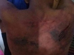 Dipukuli Marinir, Bocah T dan M Trauma dan Mesti Didampingi Psikolog