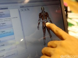 Pasien Alami Patah Tulang saat Ditangani Koas, RSU Zainal Abidin Menjawab