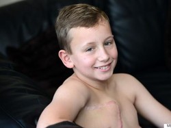 Ada Tumor Langka di Dadanya, Bocah Ini Harus Jalani Mastektomi