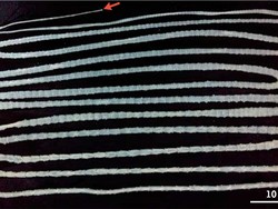 Cacing Pita 6 Meter Bersemayam di Usus Gara-gara Makan Daging Mentah