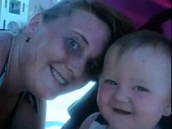 Tanda Lahir Meledak, Wanita Ini Ternyata Punya Tumor