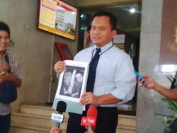 Begini Awal Mula Polisi Ungkap Sindikat Transplantasi Ginjal Ilegal