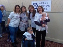 Bukannya Jutek, Gadis Ini Tak Bisa Senyum karena Kondisi Langka