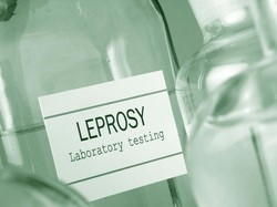 Eks Petinggi WHO Soroti Kusta Bangkit Lagi di Rumania Setelah 44 Tahun, Ternyata WNI