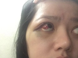 Beredar Cerita Penganiayaan Oleh Masinton Versi Dita, Ini Penelusurannya