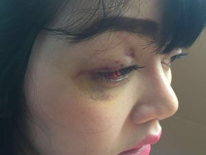 Mengaku Dianiaya Masinton, Dita Sambangi LBH Apik Pagi ini