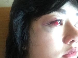 Dita Siap Jelaskan Dugaan Penganiayaan Oleh Masinton Hari Ini