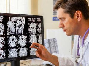 Tumor di Otak pada Wanita Ini Picu Delusi Menyeramkan