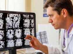 Tumor di Otak pada Wanita Ini Picu Delusi Menyeramkan