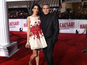Dibalut Dress Mini, Istri George Clooney Pamer Kaki Jenjang