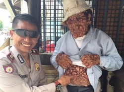 Pak Polisi ini Sapa dan Bantu Pria Tua yang Dihinggapi Penyakit Misterius