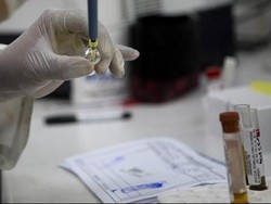 Kasus di AS: Virus Zika Ditularkan Melalui Hubungan Seks