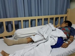 Bocah Berusia 8 Tahun Ditembak Begal di Bekasi